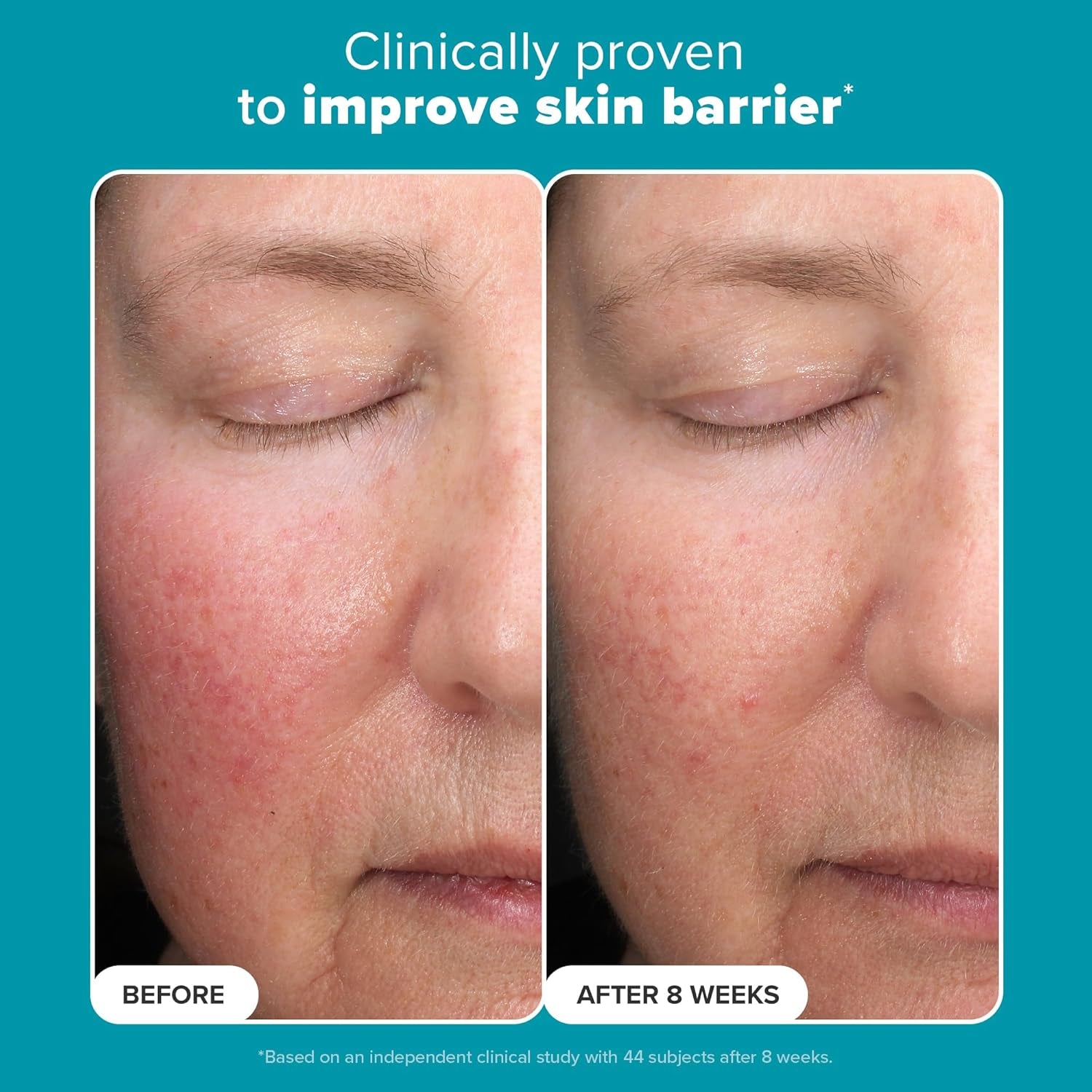 Paula’S Choice 6% Mandelic Acid + 2% Lactic Acid Exfoliant, Gentle Daily AHA Exfoliant, Face Exfoliator for Discoloration, Bumpy Texture & Radiance, for Sensitive Skin, Fragrance-Free
